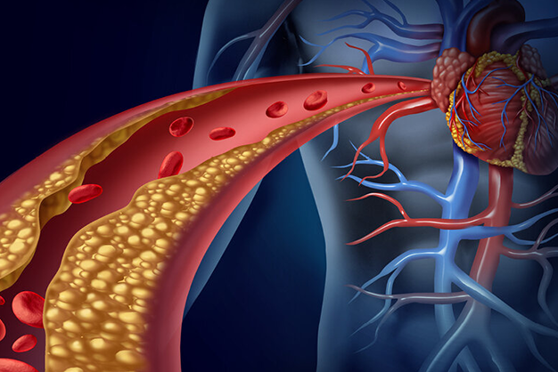 A modern approach to heart health