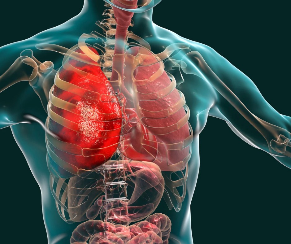 lungs